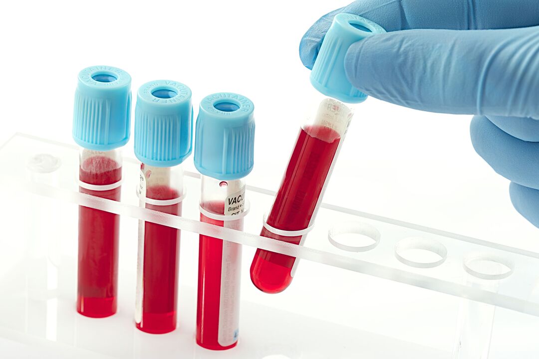 test sanguin pour diagnostiquer le papillomavirus humain