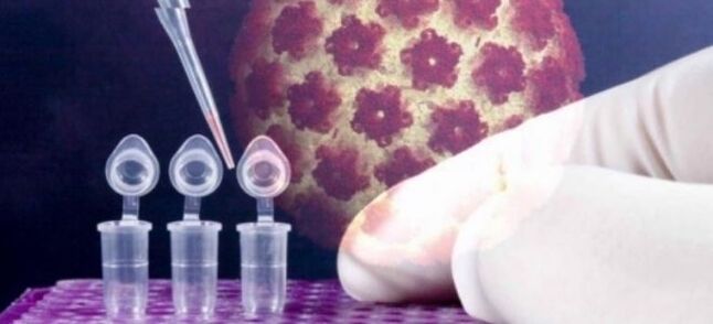 Diagnostic HPV à l'aide du test digene