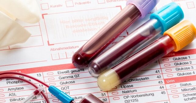 Test sanguin pour le papillomavirus humain